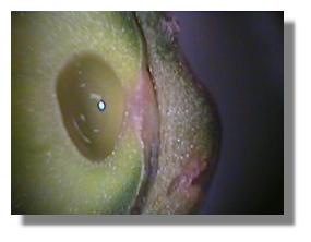Section through mature ovary